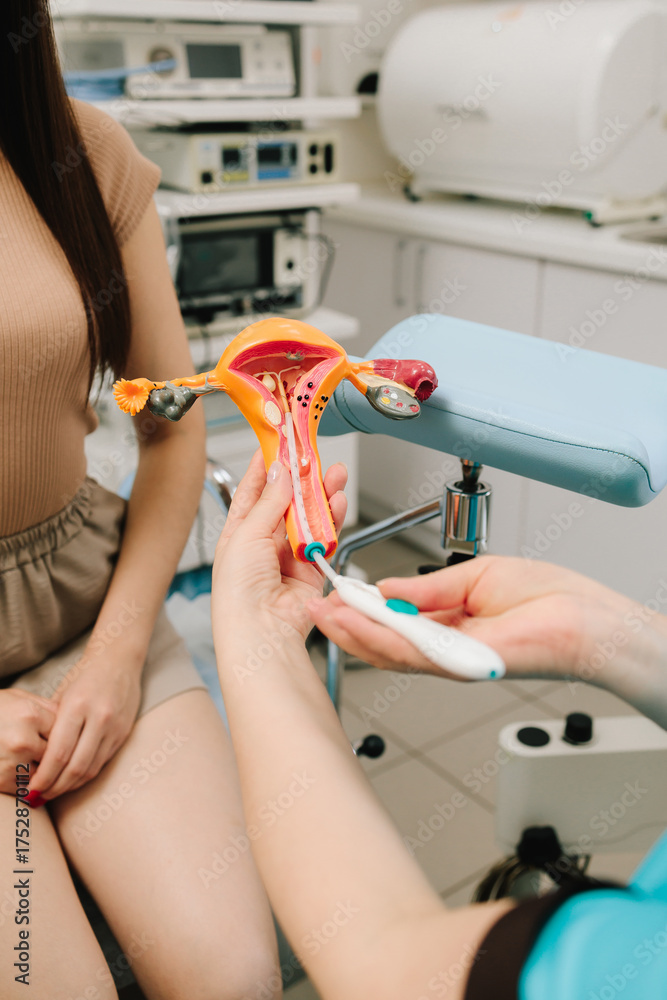 Gynecologist demonstrates contraceptive IUD insertion through cervical ...