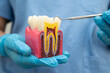 © kanruthai - Teeth root dental model with tool for dentist use to cleaning care treatment.