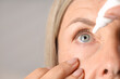 © New Africa - Woman applying eye drops on light background, closeup. Space for text