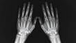 © StocksJust4You - Human adult hands bones X-ray image, used for medical study, orthopedics, and anatomy education