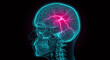 © Olesya - Human head x-ray with brain pain representation. Medical visualization for headache, migraine, and neurological disease concept. Stroke study.