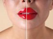 © New Africa - Female lips before and after augmentation procedure, closeup. Photo divided into halves