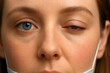 © Dr MEK - Close-up of facial asymmetry showing drooping eyelid, useful for illustrating ptosis, Bell’s palsy, or neurological symptoms.