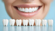© wolfelarry - Woman shows perfect white teeth next to dental shade guide with tooth models. She has a bright smile, representing dental care