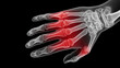 © Jenjira - Rheumatoid and arthritis concept ,hand x ray red inflamed knuckle bone joint pain arthritis medical wrist finger aching focus