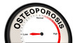 © Herman - Osteoporosis at low severity displayed on a barometer or tachometer, indicating mild bone fragility and low fracture risk, manageable with lifestyle adjustments, nutrition, and routine monitoring