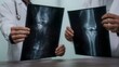© Thares2020 - Two medical professionals hold and review knee X ray films discussing diagnostic findings and potential treatment options