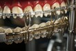 © juliars - Detailed view of dental braces on a model showcasing orthodontic treatment