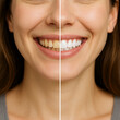 © Ozi - Close-up of woman smile showing before and after teeth whitening result with healthy white teeth comparison isolated on grey background