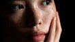 © LimeSky - Young Asian woman with melasma and freckles shows concern while touching her face highlights skin issues like sun allergies and acne treatment