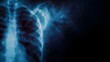 © Thares2020 - Medical X ray of a human chest detailing anatomical structures with ethereal blue light
