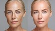 © Elshad - Female face comparison after rejuvenation or photo retouch