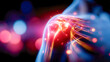 © Aliaksandra - Futuristic anatomical illustration of a shoulder with highlighted pain points, representing injury, inflammation, and medical diagnostics