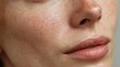 © Serhii - Closeup of Female Skin with Enlarged Pores and Redness, Highlighting Texture on Cheekbones and Facial Features