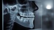 © Di Studio - X-ray of the jaws