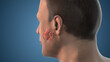© Green - Human Anatomy Salivary Gland Tumor Growth
