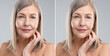 © New Africa - Woman before and after anti-aging treatment on grey background, closeup. Collage showing skin rejuvenation