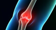 © reinh.art - human knee joint with pain and inflammation, medical concept of joint issues