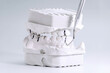 © Maximusdn - Dental plaster model with marked occlusion points