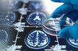 © Westend61 - Gloved hand holding petri dish over brain MRI scan for Alzheimer's research