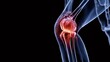 © Oleh - Human leg x ray showing an anatomical view of the knee joint with a highlighted red area representing chronic pain, arthritis, or inflammation in the skeletal structure