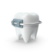 © Design Mystery - tooth with metal orthodontic bracket appliance, PNG