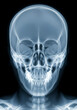 © MUHAMMAD - Anterior view X-ray of a human skull showing cranial and facial bones for medical analysis