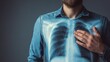© LimeSky - Close up of a young man with a lung x ray on his chest