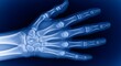 © AiStock B - Hand x ray image for medical diagnosis and bone fracture analysis for healthcare professionals
