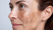 © Marut - Macro of dark spot pigmentation on cheek facial skin detail adult woman closeup dermatology uneven tone natural aging healthy calm expression