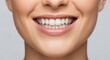 © photoplotnikov - Close-up of a smiling young caucasian female showing healthy teeth