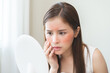 © KMPZZZ - Dermatology, scratch asian young woman looking at mirror, expression worry and itch, itchy allergy or allergic sensitive reaction, red spot or rash on her face. Beauty care from skin problem treatment