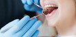 © Parilov - Professional oral caries treatment, Female caucasian adult receiving dental checkup with dentist using tools