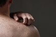 © Seventyfour - Middle aged Caucasian man scratching shoulder showing skin with visible moles and freckles highlighting dermatological concern