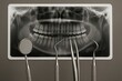 © Mariia - Dental tools in front of a detailed panoramic tooth X-ray, symbolizing oral diagnostics, professional dentistry, treatment planning, and modern dental care