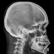 © Solid design  - x ray of human skull lateral view ,Lateral Skull Radiograph,Cranial Bones,