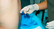 © Nekrasov - An anesthesiologist administers spinal anesthesia to a patient using a special needle. A close-up of the anesthesiologist's hands, wearing sterile gloves, holding an epidural anesthesia needle.