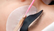 © Parilov - Eyelash removal beauty procedure with tools and pads macro photo