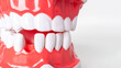 © Natasha  - Close-up of dental model showing perfect teeth and gums