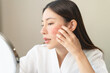 © Pormezz - Asian young woman looking face skin in the mirror have a red rash on her face from cosmetic allergy