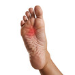 © PNG Store - Foot Pain on the Sole of a Person's Foot