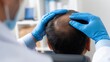© Saniya - Trichologist examining a man’s scalp for hair loss treatment