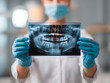 © Yurij - Dentist or medical professional wearing gloves and protective mask holding a dental panoramic X-ray film showing teeth and jaw structure against blurred clinic backg