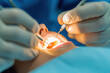 © Tichila - Dentist using dental instruments to examine a patient's teeth during a checkup. Close-up view of a dentist's gloved hands holding instruments to examine a patient's open mouth and teeth with bright.