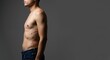 © NN AI - Shirtless man with red skin rash on his torso. Dermatological condition like shingles, psoriasis or allergic reaction. Medical concept with copy space