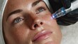 © Justlight - Focused medium shot capturing plasma device targeting scars for skin rejuvenation on a patients cheek.