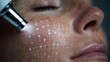 © Olga Ко - Macro view of fractional CO2 laser skin resurfacing pattern on female cheek