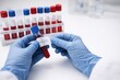 © Ekaterina - Laboratory Technician Holding Blood Sample Tube for Analysis, Surrounded by Multiple Tubes Displaying Vivid Red Contents in a Clinical Environment