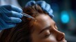 © EndlessVFX - Woman receiving hair restoration treatment with syringe