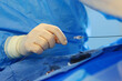 © Alla - Operations to remove blood clots.Prevention of blood clots. Endovascular surgery. Surgical interventions on blood vessels.